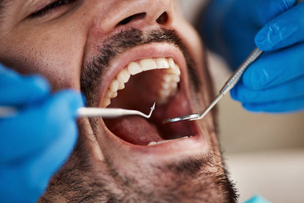 Best Tooth Extraction  in Carthage, IL